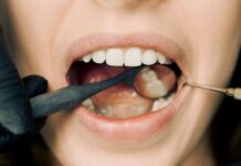 Od talíře k úsměvu: Jak strava ovlivňuje dentální zdraví
